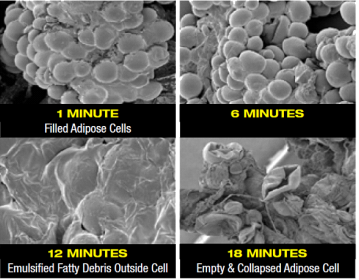 invisa-red fat cells